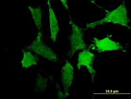 H00140885-M10 - CD172a / SIRPA