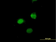 H00143686-B01P - Sestrin-3 (SESN3)