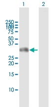 H00145258-D01 - Homeobox protein goosecoid / GSC