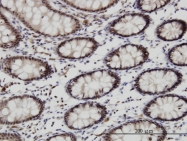 H00145258-M01 - Homeobox protein goosecoid / GSC