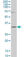 H00145258-M03 - Homeobox protein goosecoid / GSC