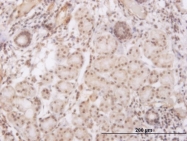 H00145258-M14 - Homeobox protein goosecoid / GSC