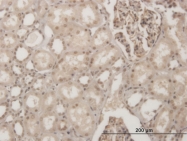 H00145258-M17 - Homeobox protein goosecoid / GSC