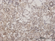 H00145258-M20 - Homeobox protein goosecoid / GSC