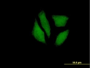 H00145553-B01P - MDP1