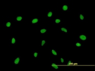 H00147837-B01P - ZNF563