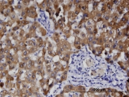 H00148738-M01 - HFE2 / Hemojuvelin