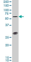 H00149233-M01 - Interleukin-23 receptor / IL23R