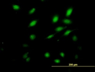 H00150372-B01P - NFAM1