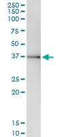 H00151648-D01 - SGOL1 / SGO1