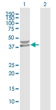 H00152926-B01P - Protein phosphatase 1K / PPM1K