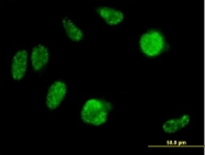 H00153572-B01P - IRX2 / IRXA2