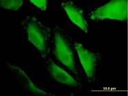 H00154214-M01 - RNF217