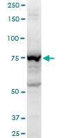 H00154796-A01 - Angiomotin
