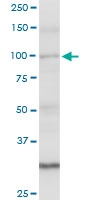 H00154810-D01P - Angiomotin-like protein 1 / AMOTL1