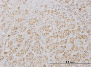 H00157285-M01 - SGK223