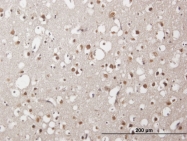 H00158399-B01P - ZNF483