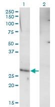 H00158800-M01 - RHOXF1 / OTEX