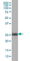 H00162466-M04 - PHOSPHO1