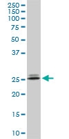 H00162466-M10 - PHOSPHO1