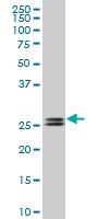 H00162466-M10 - PHOSPHO1