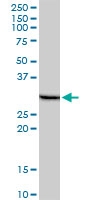 H00162466-M10 - PHOSPHO1