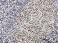 H00162979-B01 - ZNF296