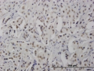 H00165918-M01 - RNF168