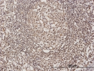 H00167826-B01 - OLIG3