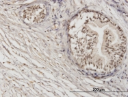 H00168374-M01 - ZNF92