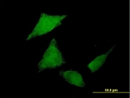 H00169436-B01 - SGK071 / C9orf96