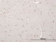 H00170302-M04 - ARX