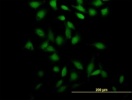 H00196441-B01 - CCDC131