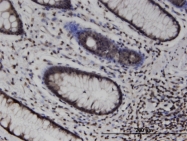 H00197259-M02 - MLKL