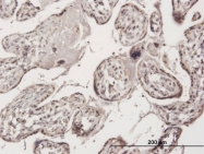 H00201514-B01 - ZNF584