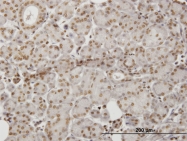 H00204851-M06 - HIPK1