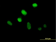 H00219749-B01 - ZNF25