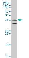 H00245972-A01 - ATP6V0D2