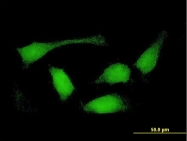 H00254122-B01P - Sorting nexin-32