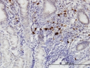 H00255426-M01 - RASGEF1C