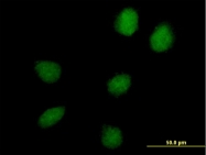 H00256957-B01P - C17orf66