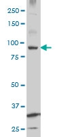 H00283455-M07 - Kinase suppressor of Ras 2