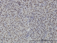 H00284119-M02 - PTRF