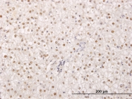 H00284355-M02 - TPRX1
