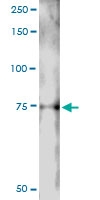 H00286826-D01 - LIN9