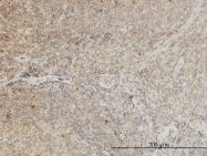 H00344387-M01 - CDKL4