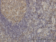 H00344387-M03 - CDKL4
