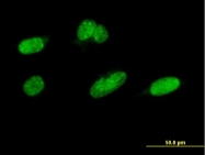 H00728642-M01 - CDK11A / CDC2L2