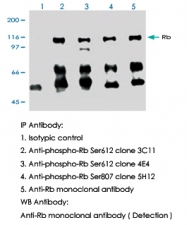 MAB0002 - Retinoblastoma-associated protein / RB1