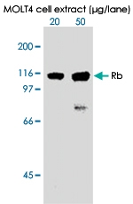 MAB0002 - Retinoblastoma-associated protein / RB1